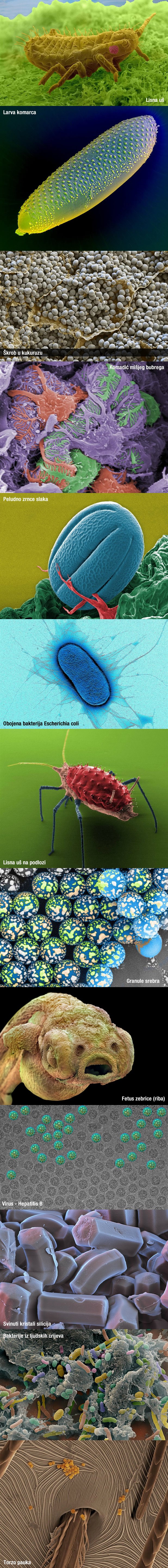 GALERIJA: Mikrosvijet vidljiv samo moćnim mikroskopima