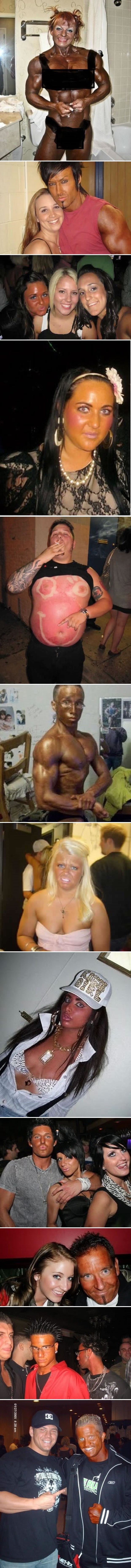 Spržili se u solariju i ubili od kreme za samotamnjenje