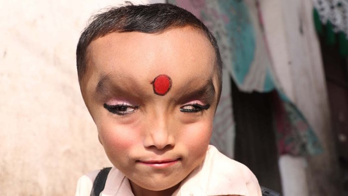 VIDEO Malog Indijca zbog specifičnog izgleda smatraju božanstvom