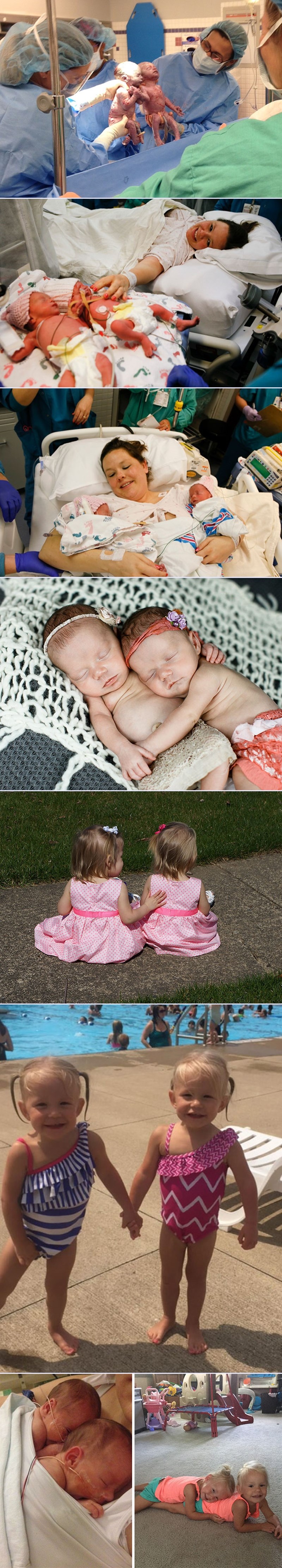 Sjećate se bebica rođenih držeći se za ruke? Danas su velike cure!