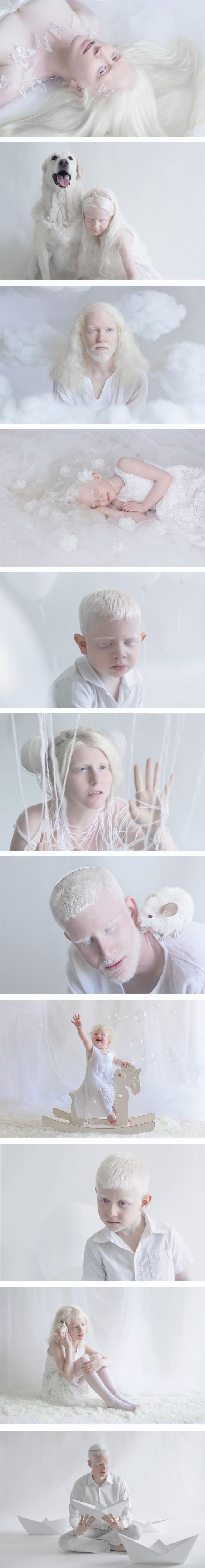 Bez boje: Ljepota ljudi s albinizmom na fotografiji