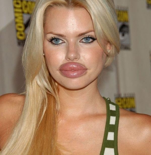 Žene su totalno skrenule: Duckface iz pakla