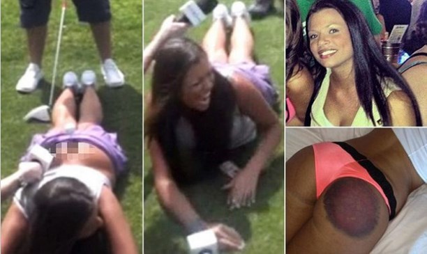 Seksi modelušu na snimanju "prebili" palicom za golf