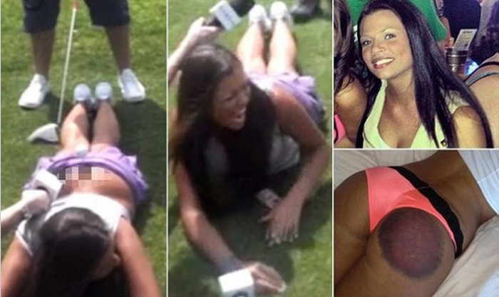 Seksi modelušu na snimanju "prebili" palicom za golf