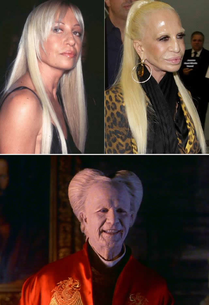 Donatella Versace od sebe napravila "čudovište"?