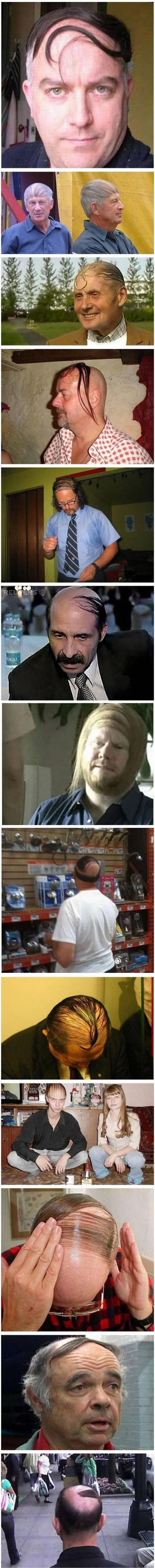 Najgori pokušaji prikrivanja ćelavosti