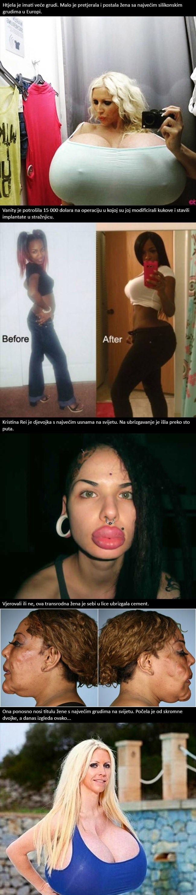 Htjele su se uljepšati, ali su od svog tijela napravile pravu katastrofu!