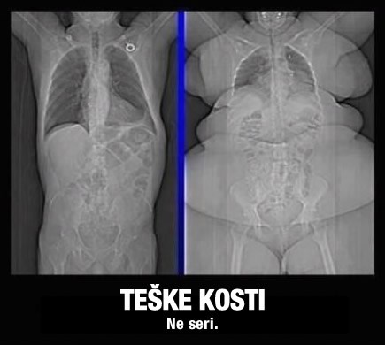 Konačni dokaz da "teške kosti" ne postoje