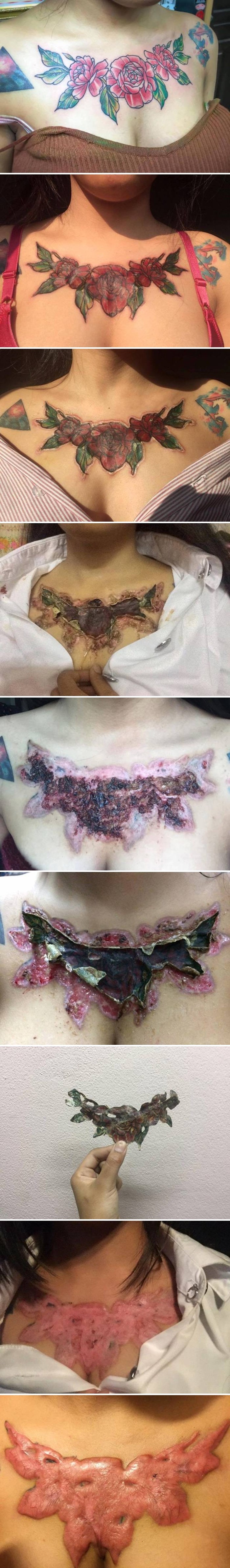 Žena je na vrlo bolan način shvatila da tetovaže mogu biti opasne