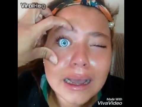 VIDEO Strašno! Djevojčica je sebi u očnu šupljinu ugurala lutkino oko, mama ga je jedva izvadila!