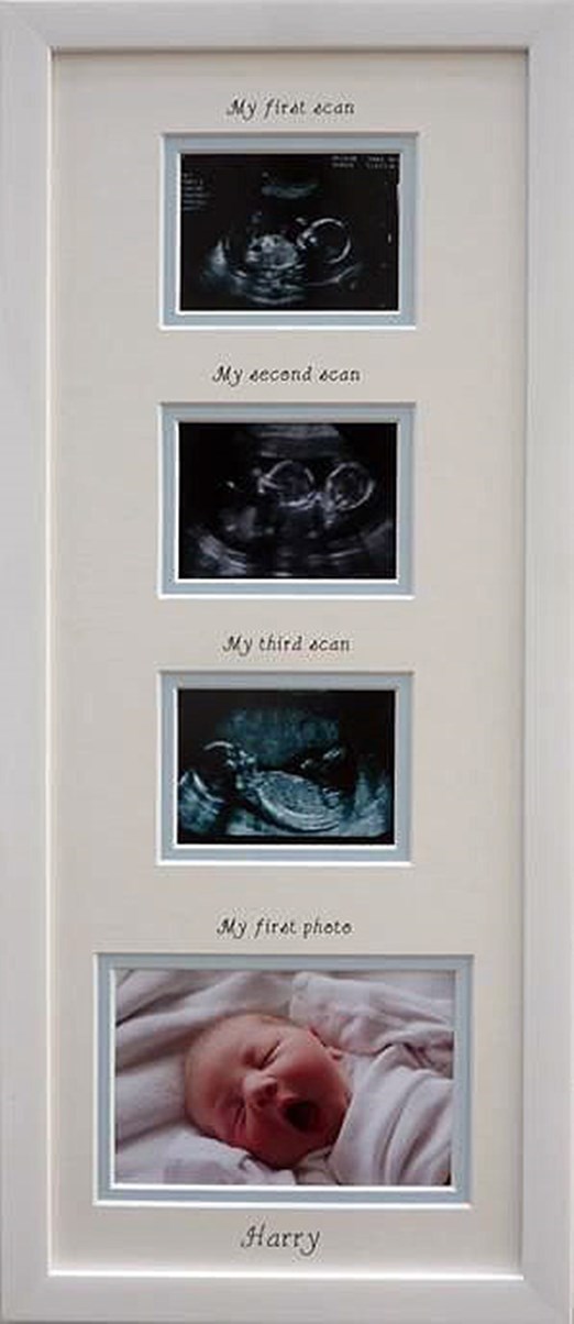 Drage mame , sjećate se čarolije prvog ultrazvuka ? Zašto je ne biste proživljavali svaki dan ?