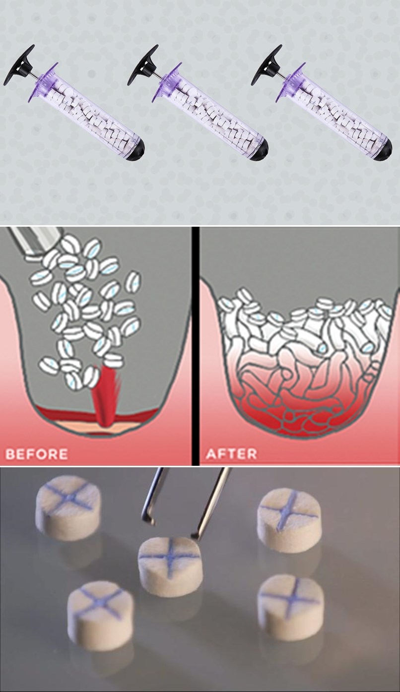 GENIJALNI IZUM spašava živote žrtvama pucnjave u manje od minute!