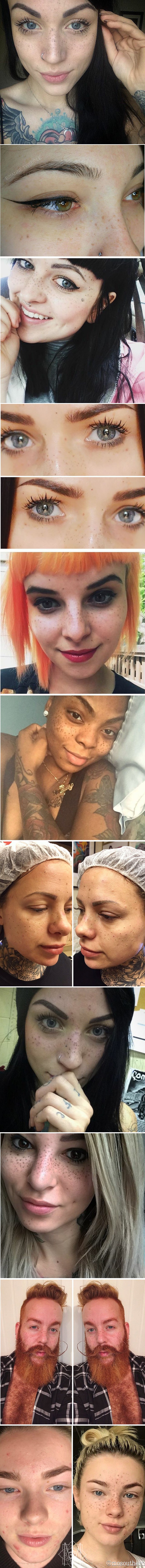 Tetoviranje pjegica - Novi modni trend zahvatio je svijet