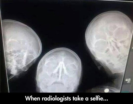 Dečki s radiologije opalili "selfie"