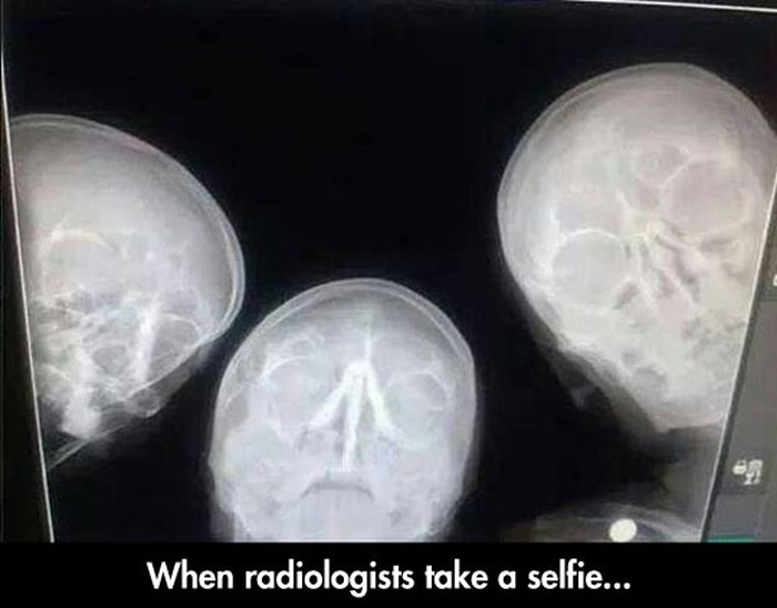 Dečki s radiologije opalili "selfie"