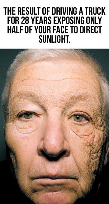 Pržite se na plaži i mislite da neće biti posljedica?