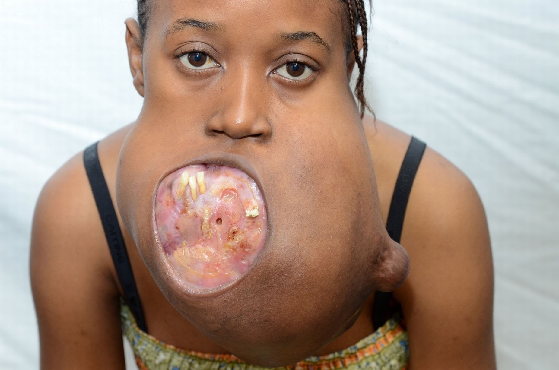 VIDEO Ove šokantne fotografije su podsjetnik da estetska kirurgija ne postoji samo zbog razmaženih zvijezda