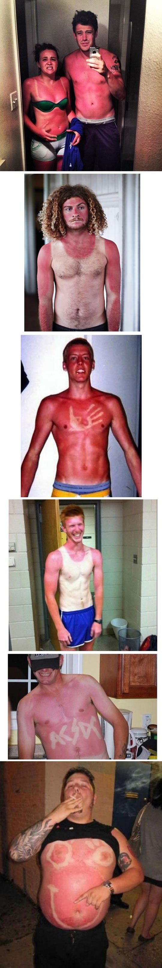 Ovi su ljudi toliko izgorjeli na suncu da je bolno samo gledati ih 