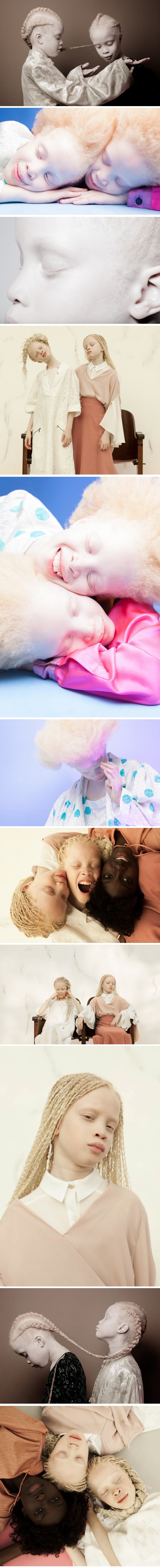 Predivne albino blizanke svojom jedinstvenošću osvojile su svijet