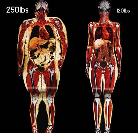Ljeto je stiglo, ne izgledajte još gore iznutra nego izvana