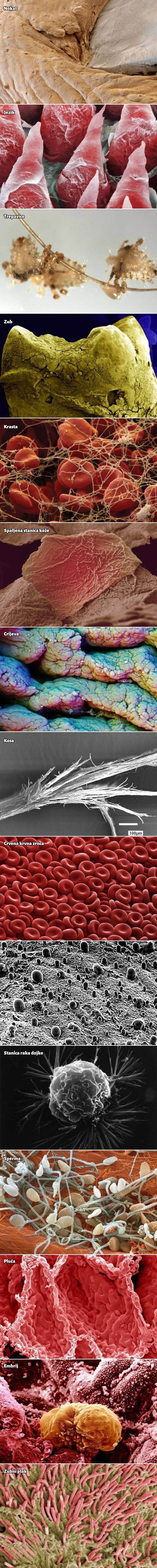 GALERIJA: Neobičan svijet ljudskog tijela pod mikroskopom