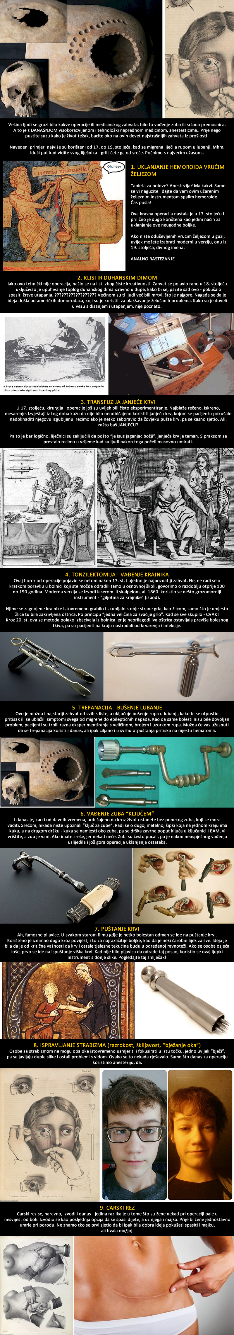 TOP 9 najužasnijih operacija iz prošlosti