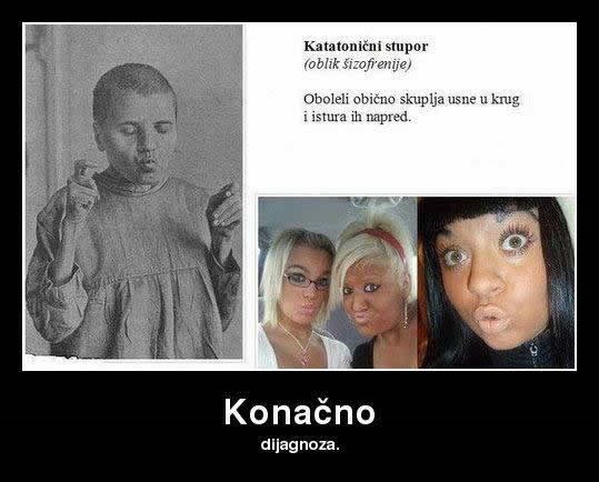 Duckface konačno dobio dijagnozu