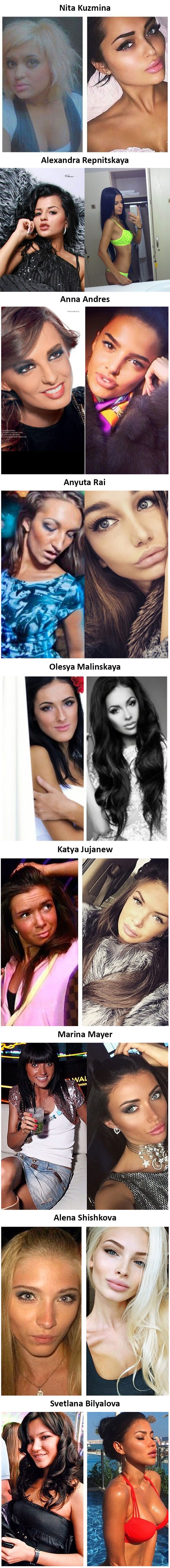 Znate li kako su zvijezde Instagrama izgledale prije plastičnih operacija?!