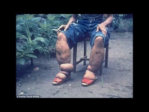 VIDEO: Komarac mu je od noge napravio užas!