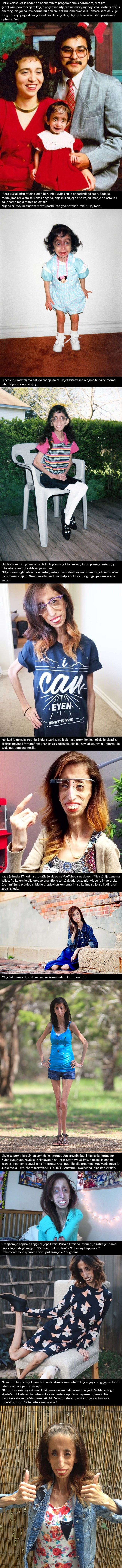 Titula "najružnije žene na svijetu" promijenila joj je život na iznenađujući način