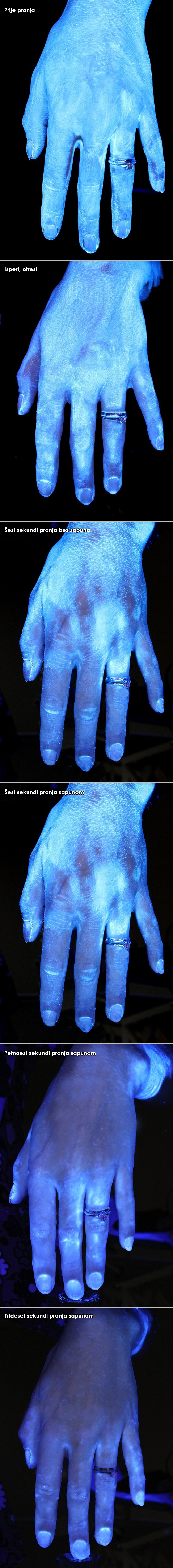 GALERIJA: Koliko treba prati ruke sapunom da biste ubili sve bakterije?