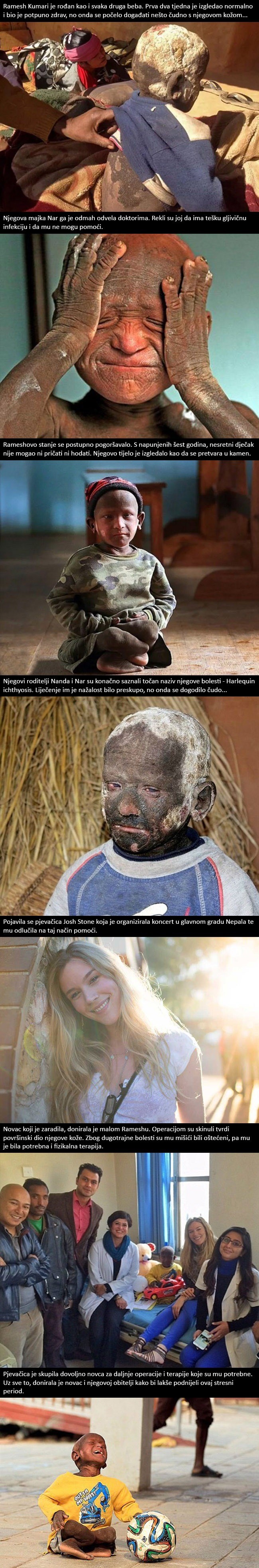 Dječakovo tijelo se zbog opake bolesti pretvaralo u kamen, a onda mu je konačno stigla pomoć!