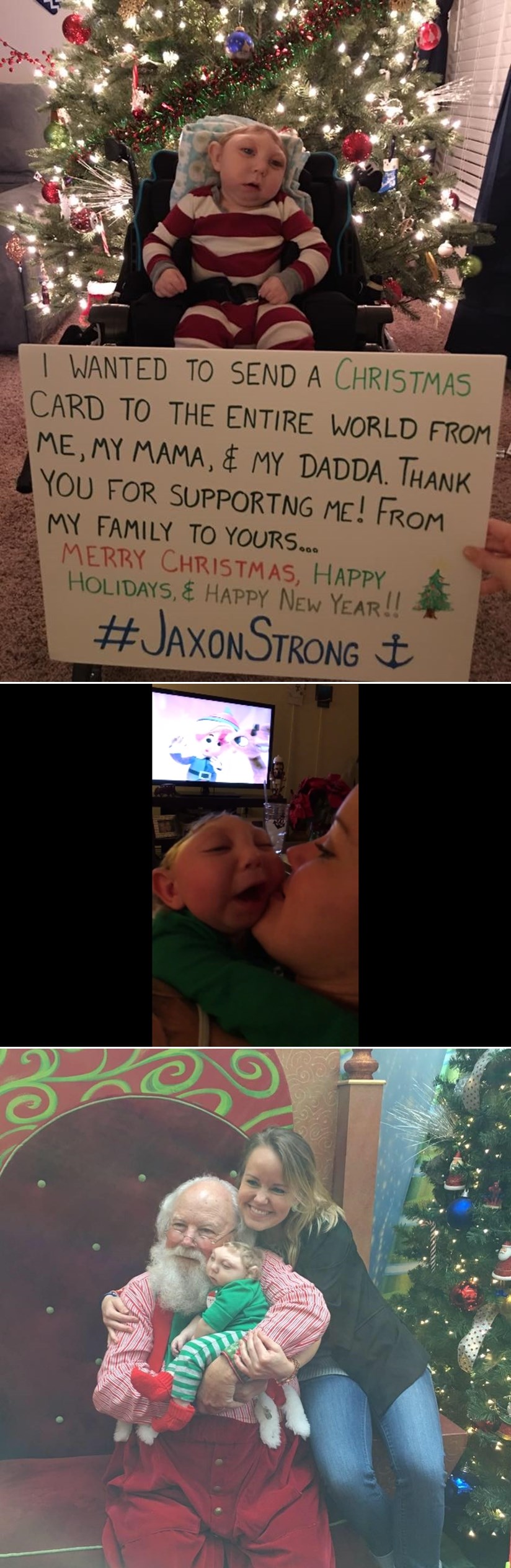 BEBA BORAC OPET POBIJEDILA: Jaxon, rođen bez pola lubanje, dočekao još jedan Božić!