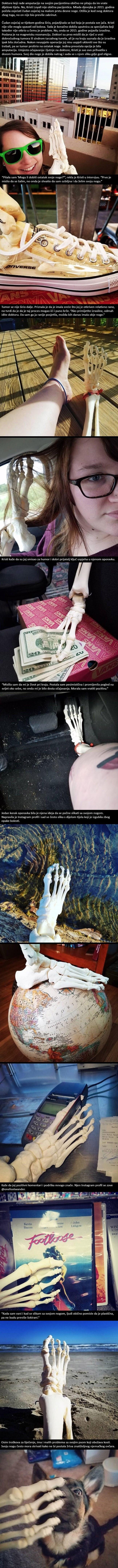 Zbog raka je izgubila nogu, ali ne i čudan smisao za humor!