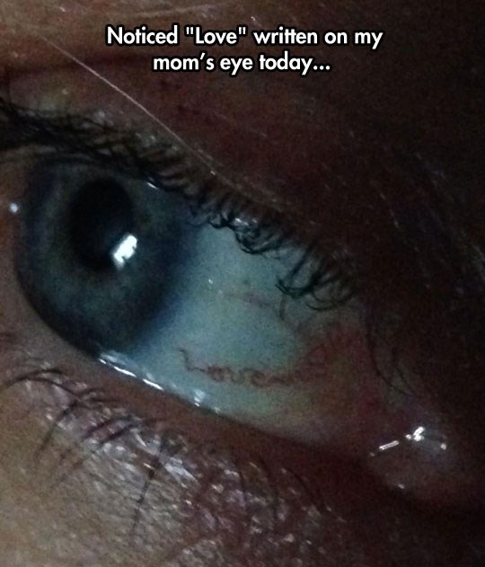 Ljubav se vidi u očima - doslovno