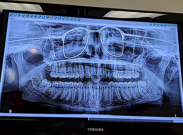 Snimao sam panoramski snimak zubiju, a zaboravili su mi reći da skinem naočale