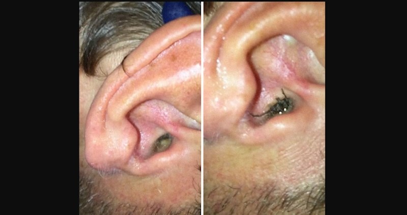 Ovi ljudi pronašli su pauka na nevjerojatnim mjestima (i više nikad neće spavati mirno)