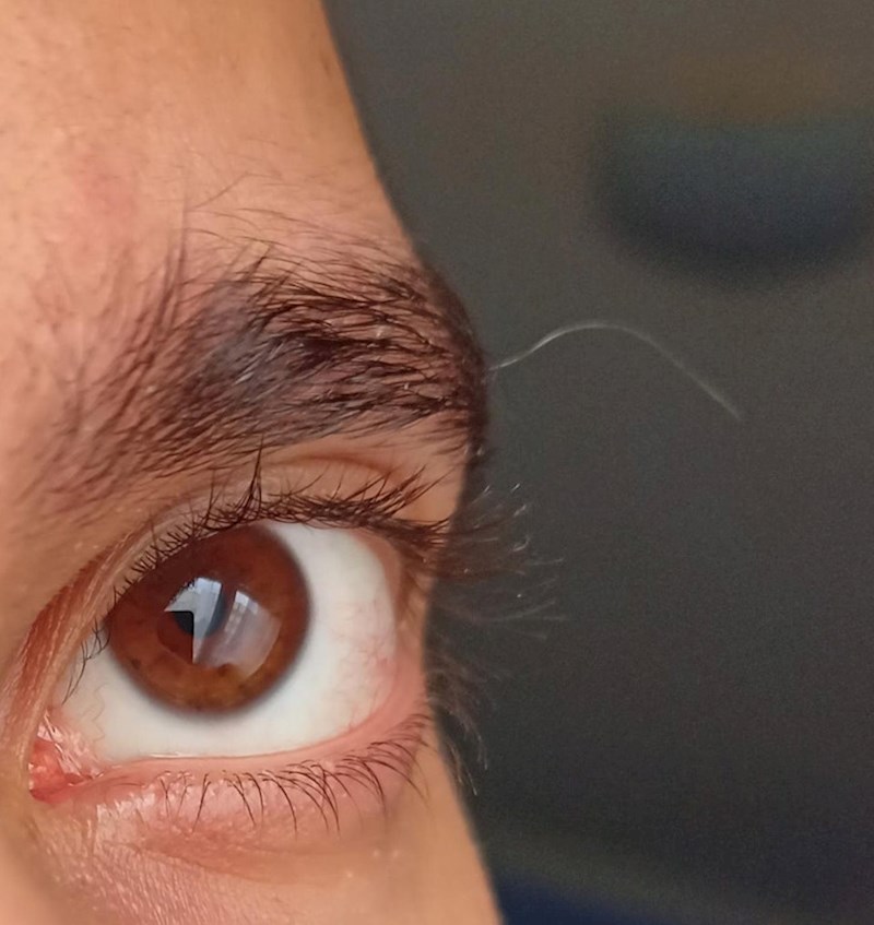 Jedina jedna sijeda vlas koju imam je na mojim obrvama i mnogo je duža od ostalih