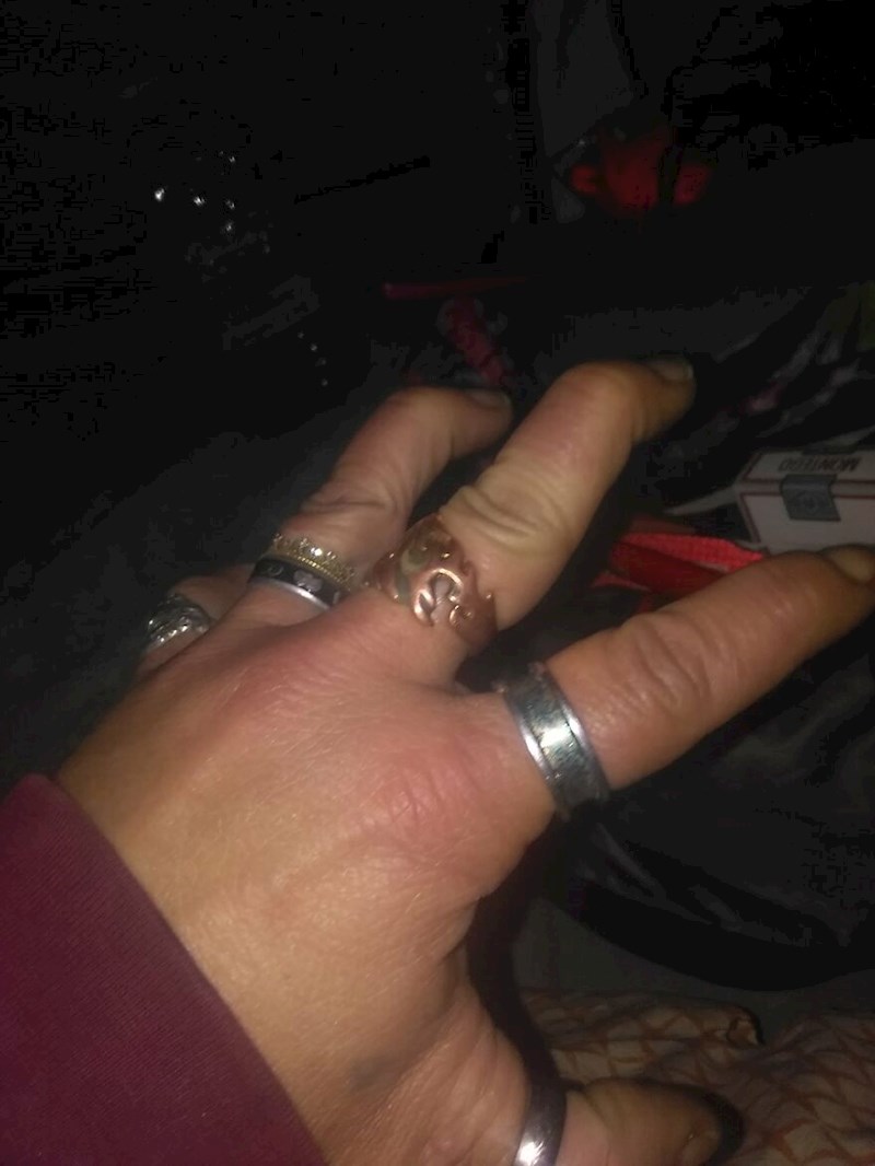 11. Ovaj tip može uvući članke na prstima