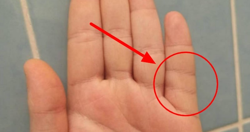 11 ljudi je pokazalo neobične fizičke osobine koje imaju samo rijetki