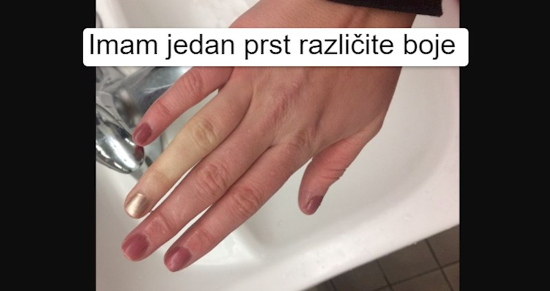 8 ljudi koji imaju totalno neobične karakteristike (i naučili su ih voljeti)