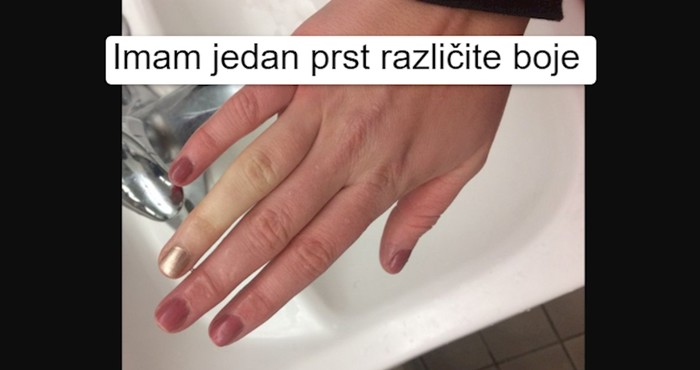 8 ljudi koji imaju totalno neobične karakteristike (i naučili su ih voljeti)
