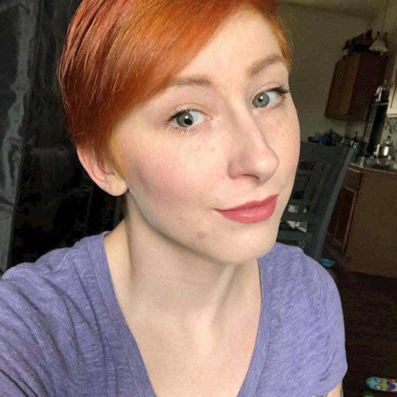 Zjenica mi je neobičnog oblika