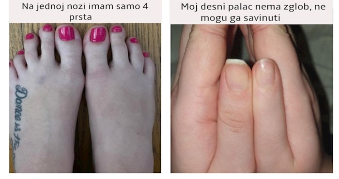 Ljudi koje je priroda učinila malo posebnijima