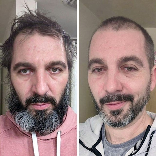 "Prije i nakon što sam počeo liječiti depresiju"