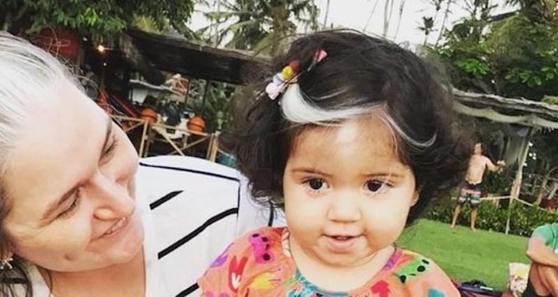 Ova genijalna curica rođena je s pramenom sijede kose, sad je Instagram zvijezda