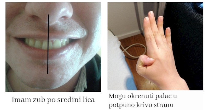 15 ljudi s rijetko viđenim tjelesnim obilježjima, iznenadit će vas