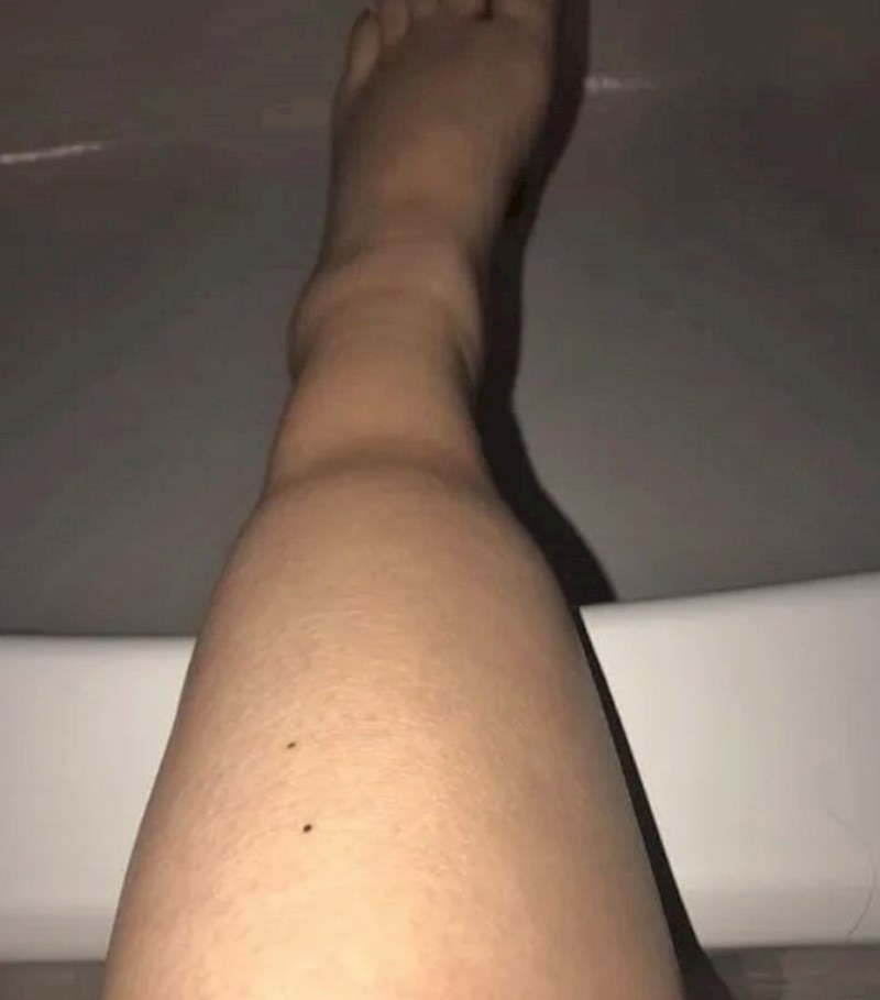 Ovo se dogodi kad trudnica nosi dokoljenke