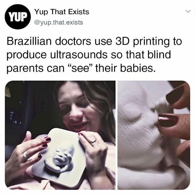 Doktori u Brazilu koriste 3D printere kako bi i slijepi roditelji mogli "vidjeti" ultrazvuk djeteta