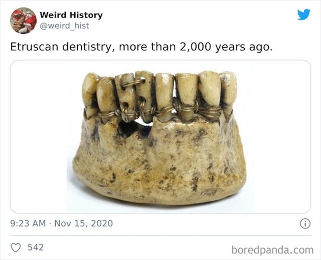 Etrušćani su imali primitivne zubare